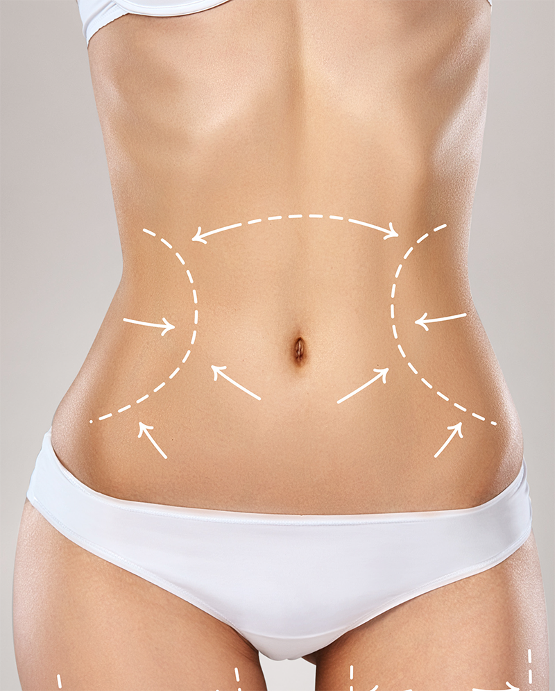Golden Body Slim 1