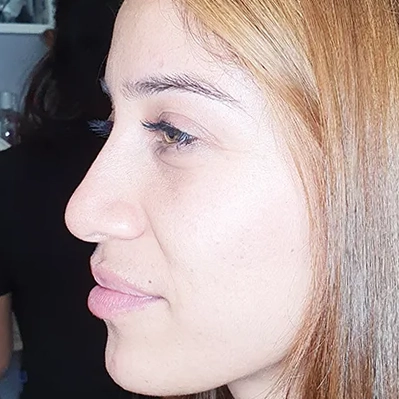 Antes